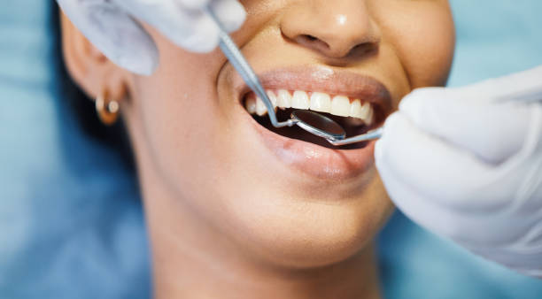 Best Walk-In Emergency Dental Services in Ashland, CA